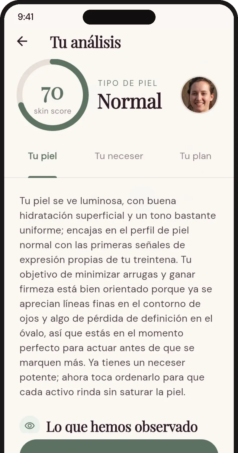 Pantalla de análisis de QUIPI Skin: skin score 70, tipo de piel normal y el texto del análisis.