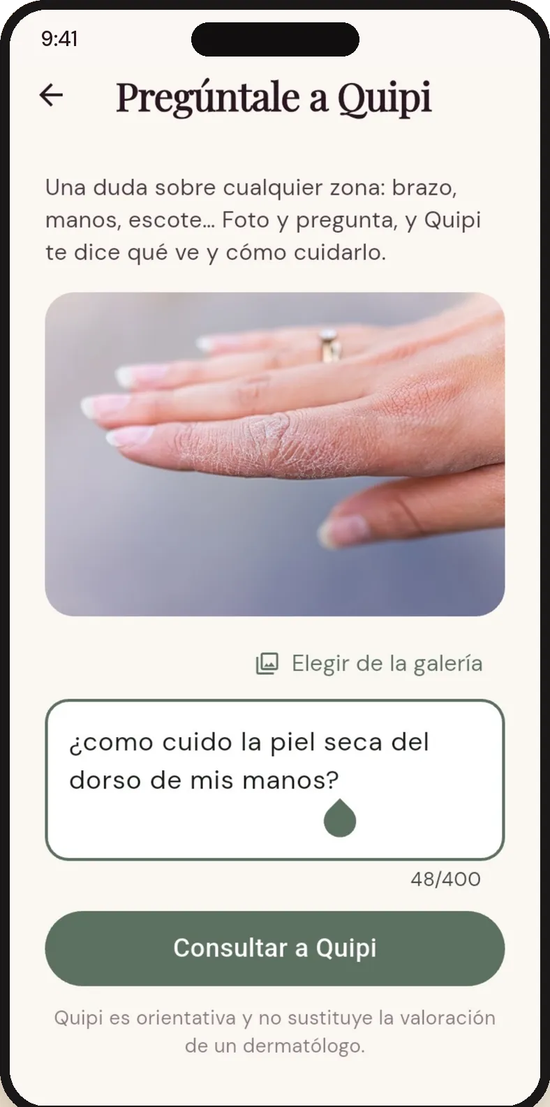 Consulta sobre la piel seca del dorso de las manos, con la foto adjunta y el botón Consultar a Quipi.