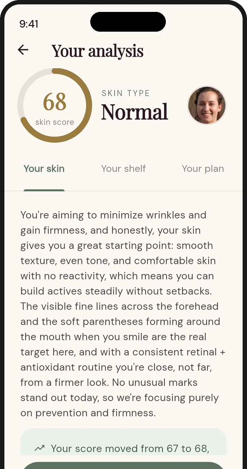 QUIPI Skin analysis screen: a skin score of 68, normal skin type and the written analysis.