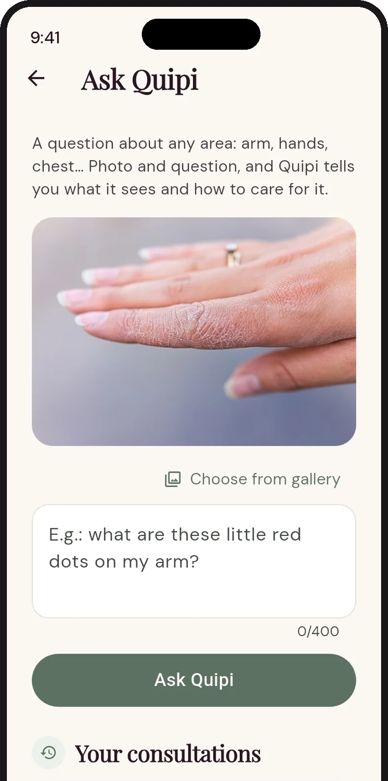 A question about dry skin on the back of the hands, with the photo attached and the Ask Quipi button.