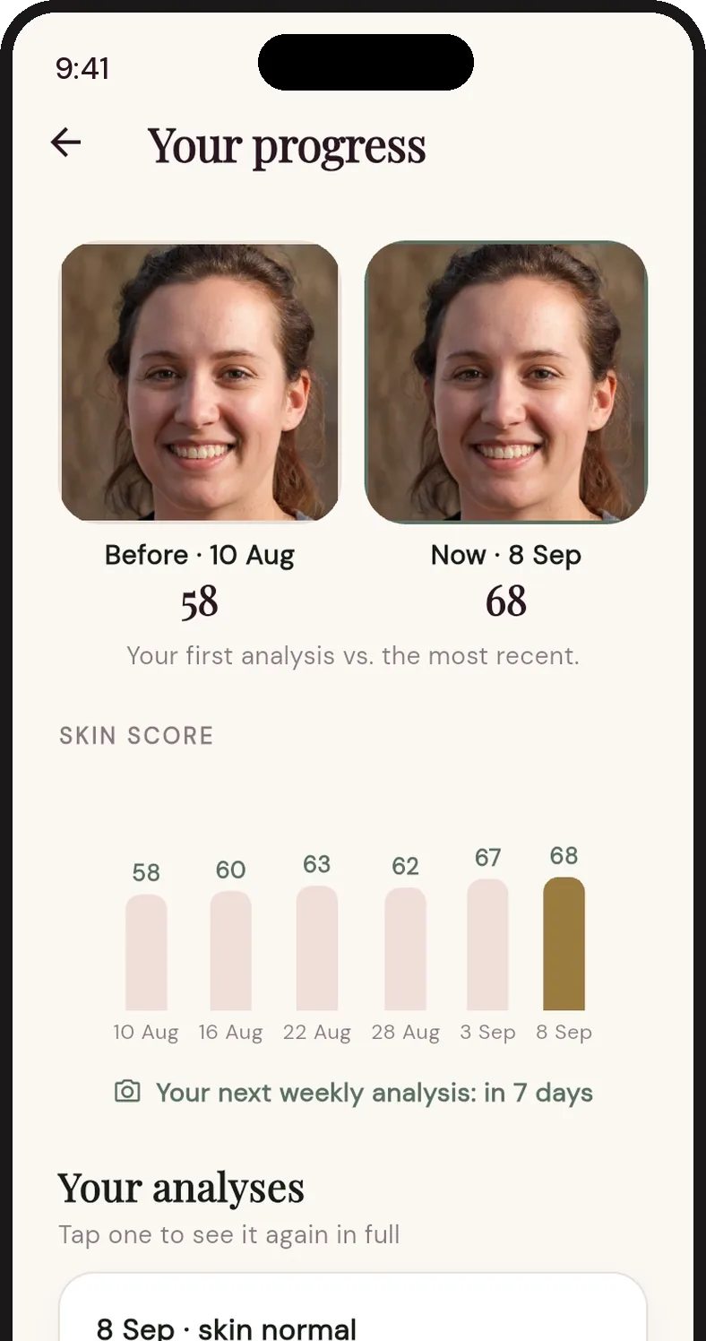 Progress screen: the first photo scoring 58 and the current one scoring 68, with the skin score chart in between.