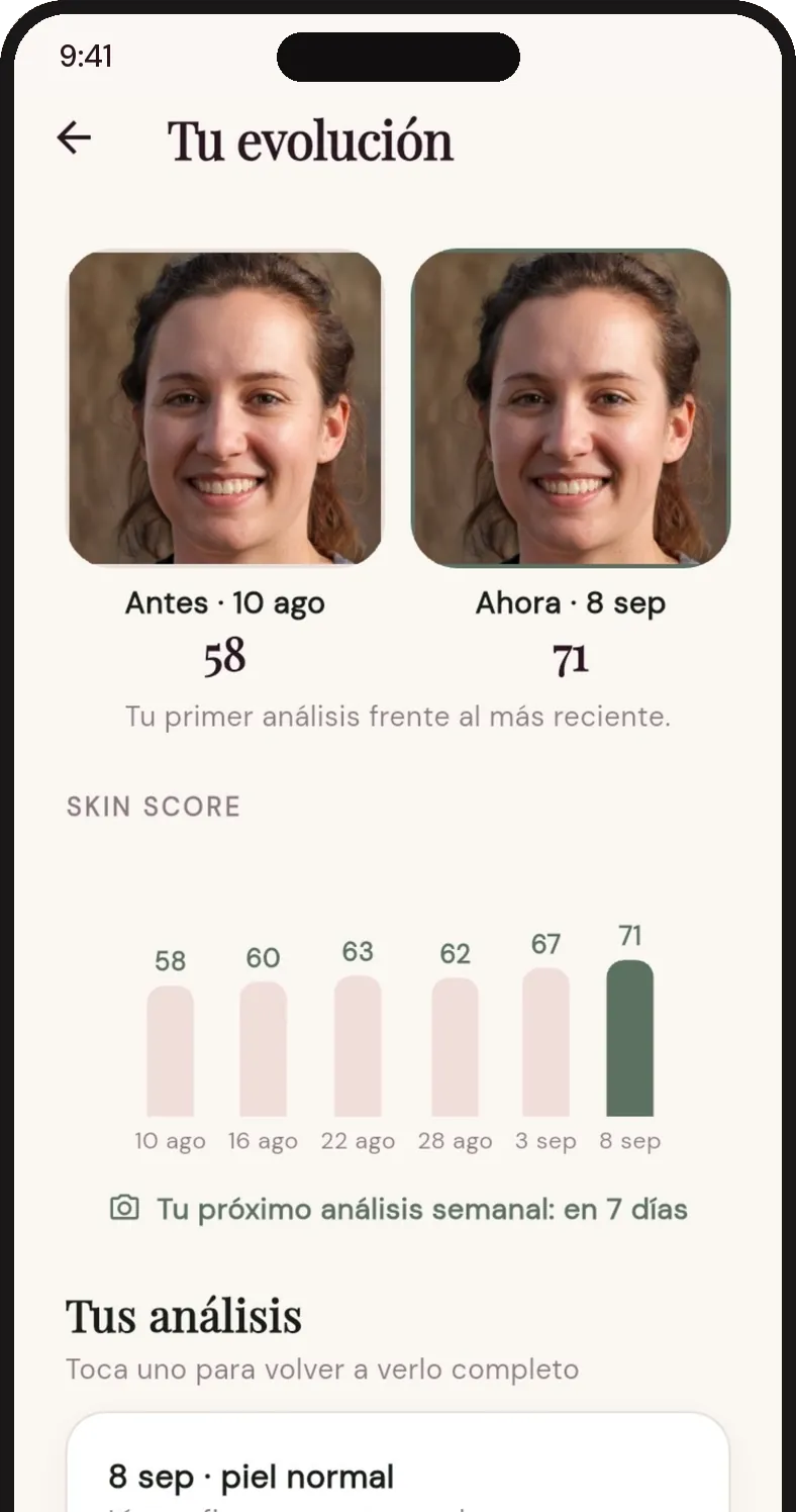 Pantalla de evolución: foto de antes con 58 puntos y foto actual con 71, y el gráfico de skin score.