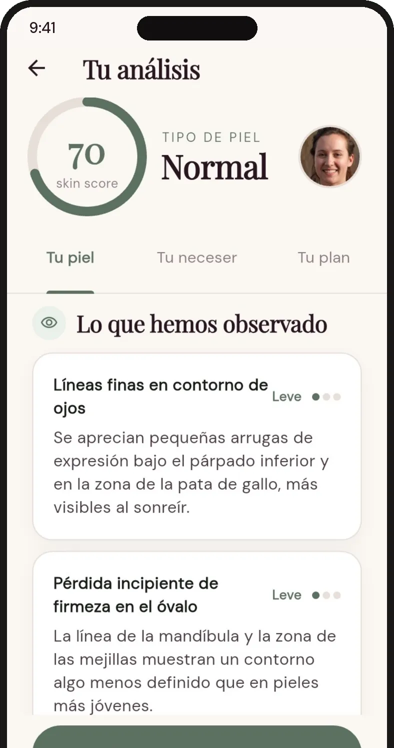 Observaciones ancladas: líneas finas en contorno de ojos y pérdida incipiente de firmeza en el óvalo, ambas leves.